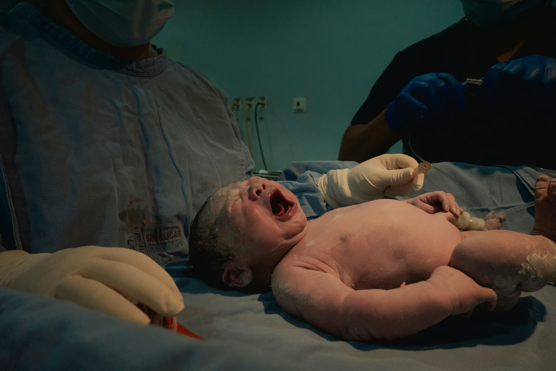 Newborn baby just after birth with medical staff